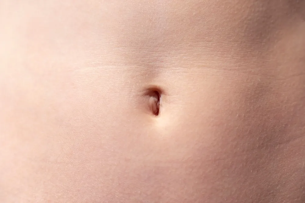 Chirurgie du nombril (ombilicoplastie) à Bruxelles, Clinique Churchill