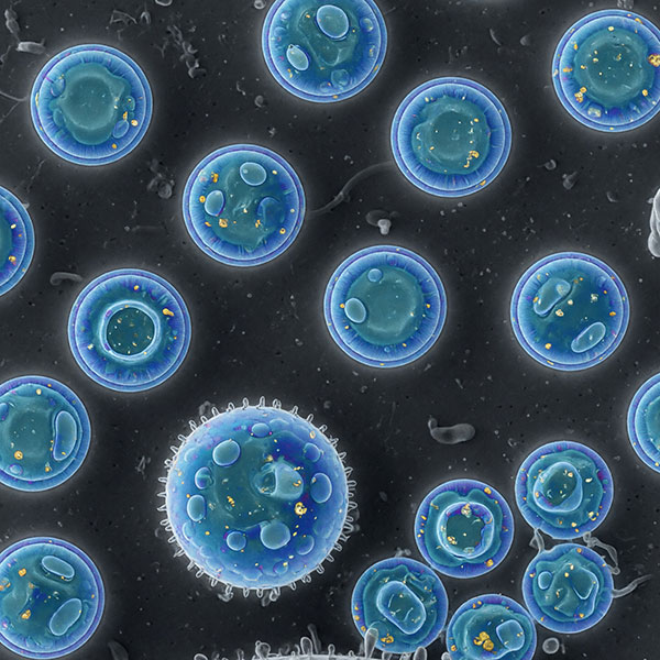 Exosomes